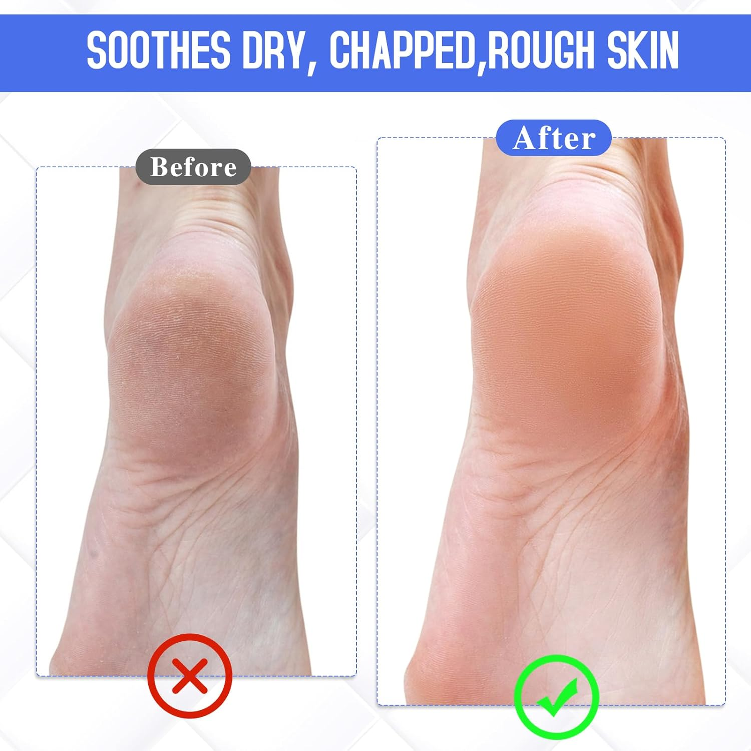 Moisturizing Socks 4