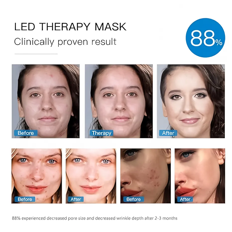 USB Rechargeable 7 Color LED Light Therapy Face Mask 3