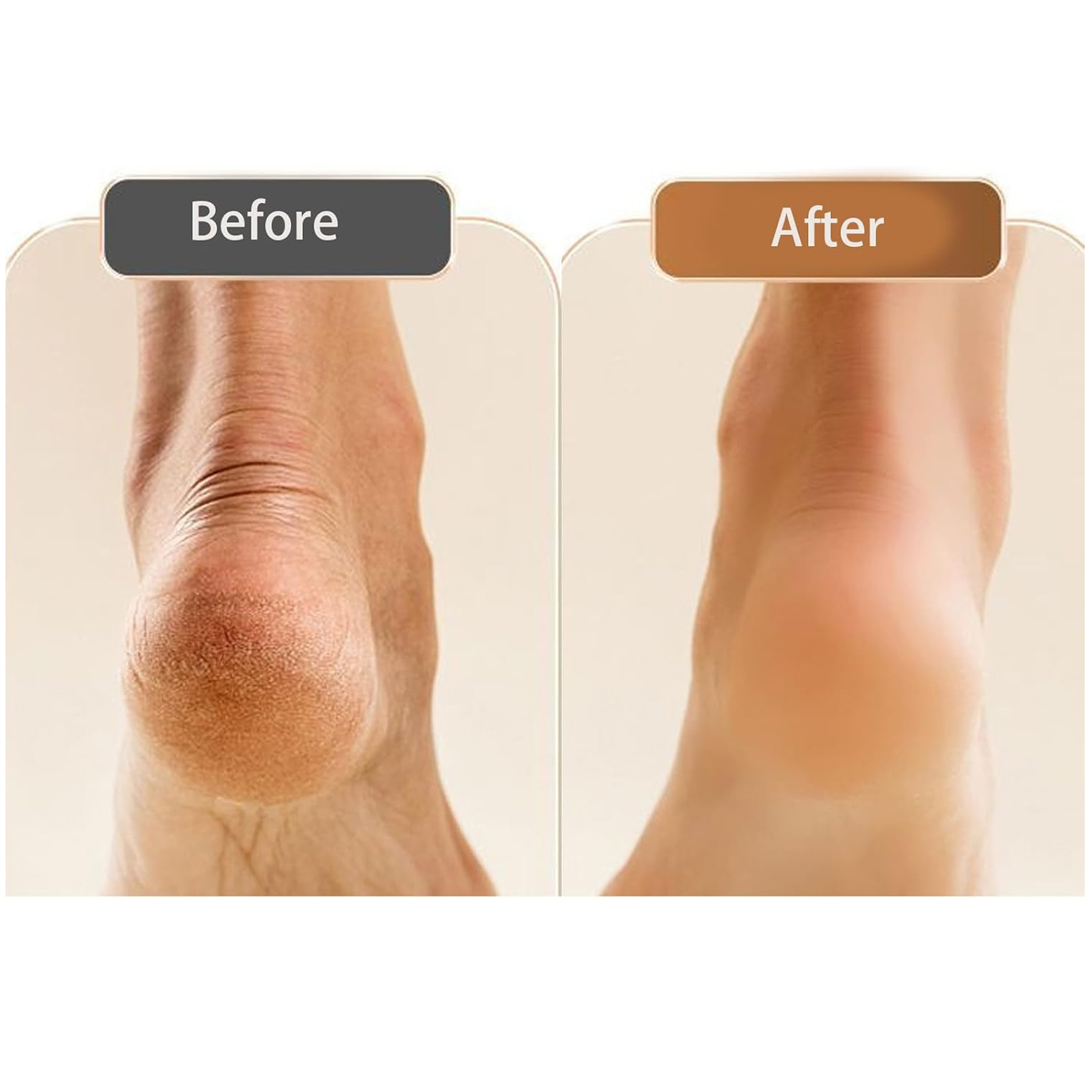 Electric Foot Callus Remover 1