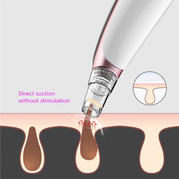 Blackhead Remover Face Clean Pore Vacuum 3