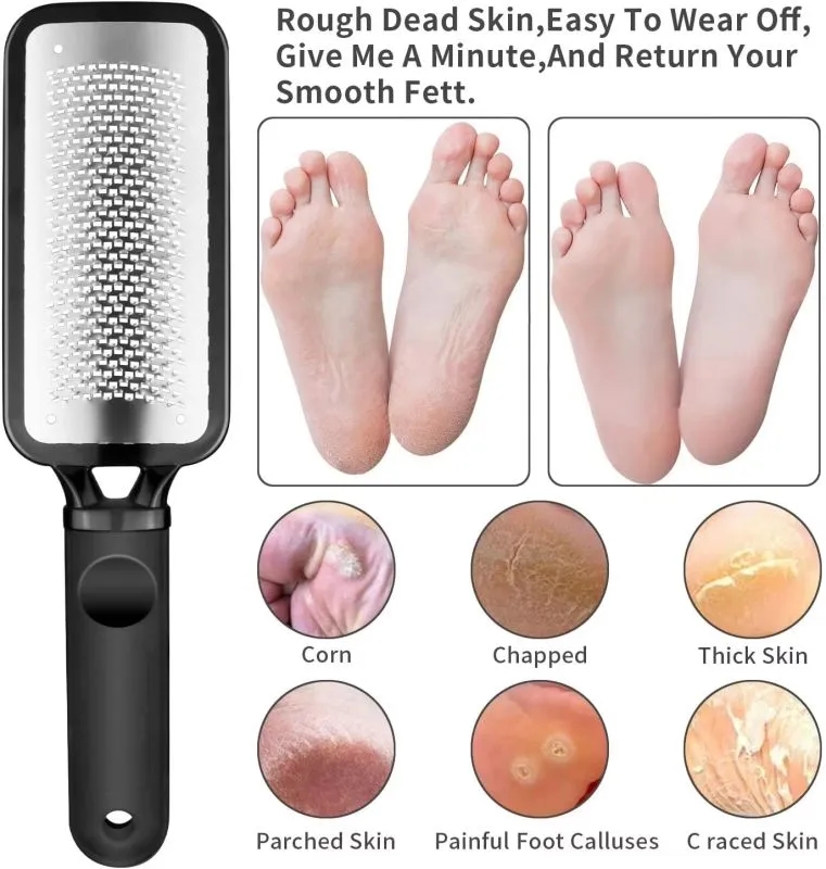 Colossal Rasp Foot File 2