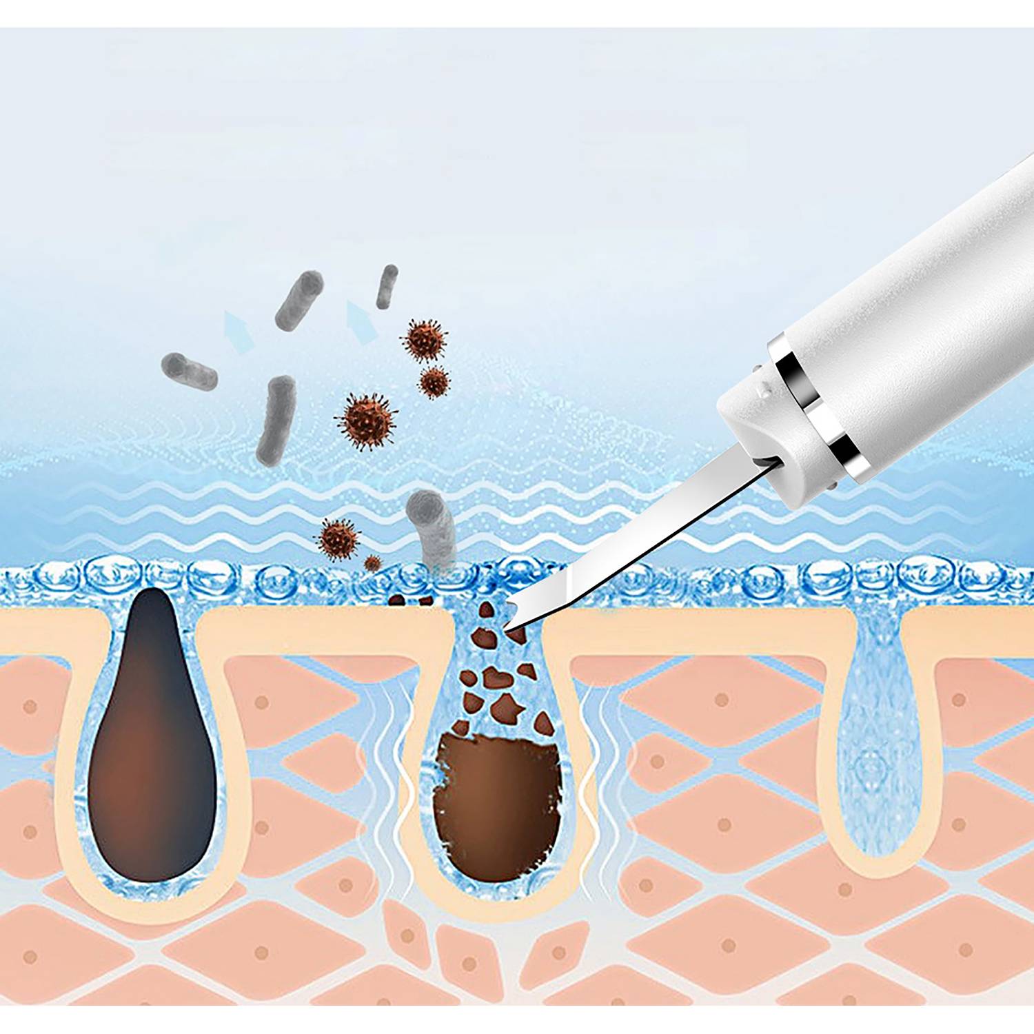 Pore Cleaner Clean Blackheads 1