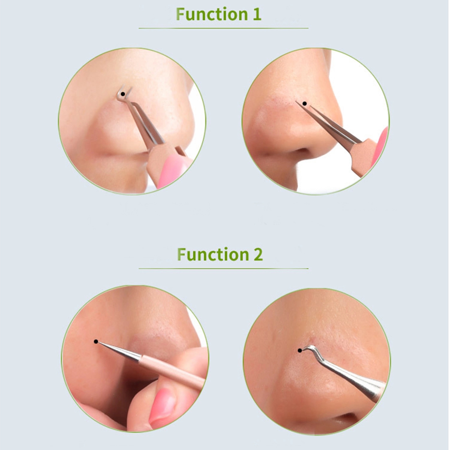 5 Pcs Acne Remover Needles Set 3