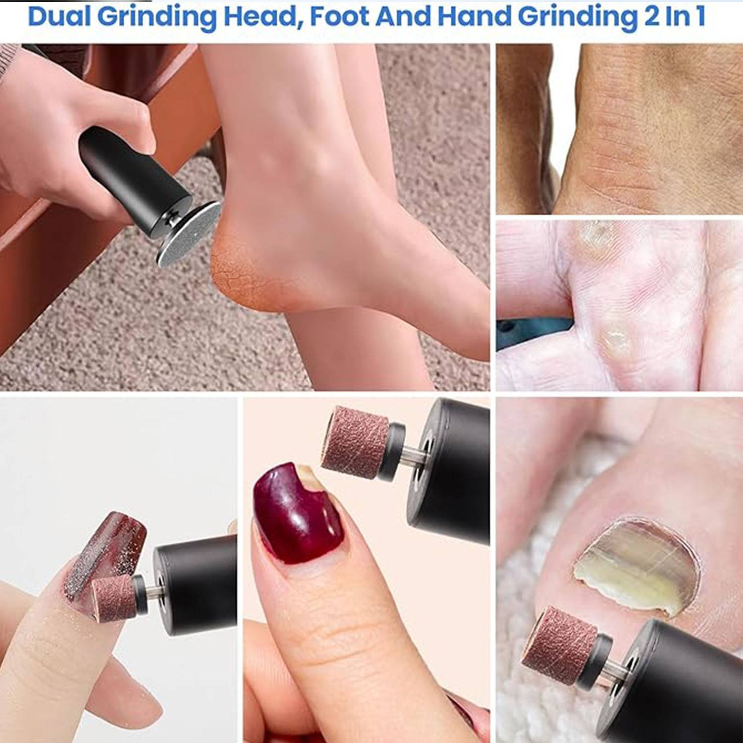 Electric Callus Remover for Feet 5
