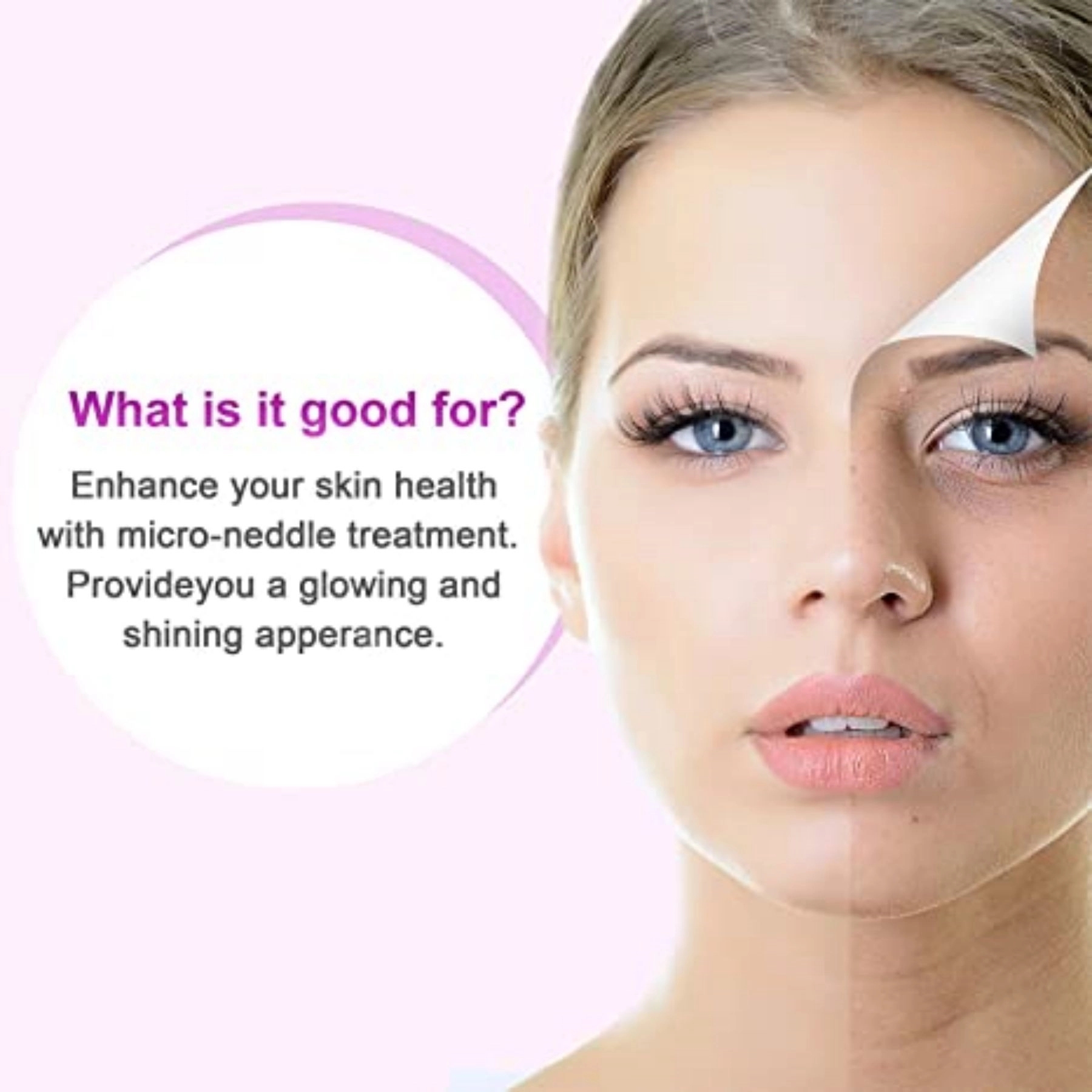 6 in 1 Dermaroller Kit for Face and Body Micro Needle 3