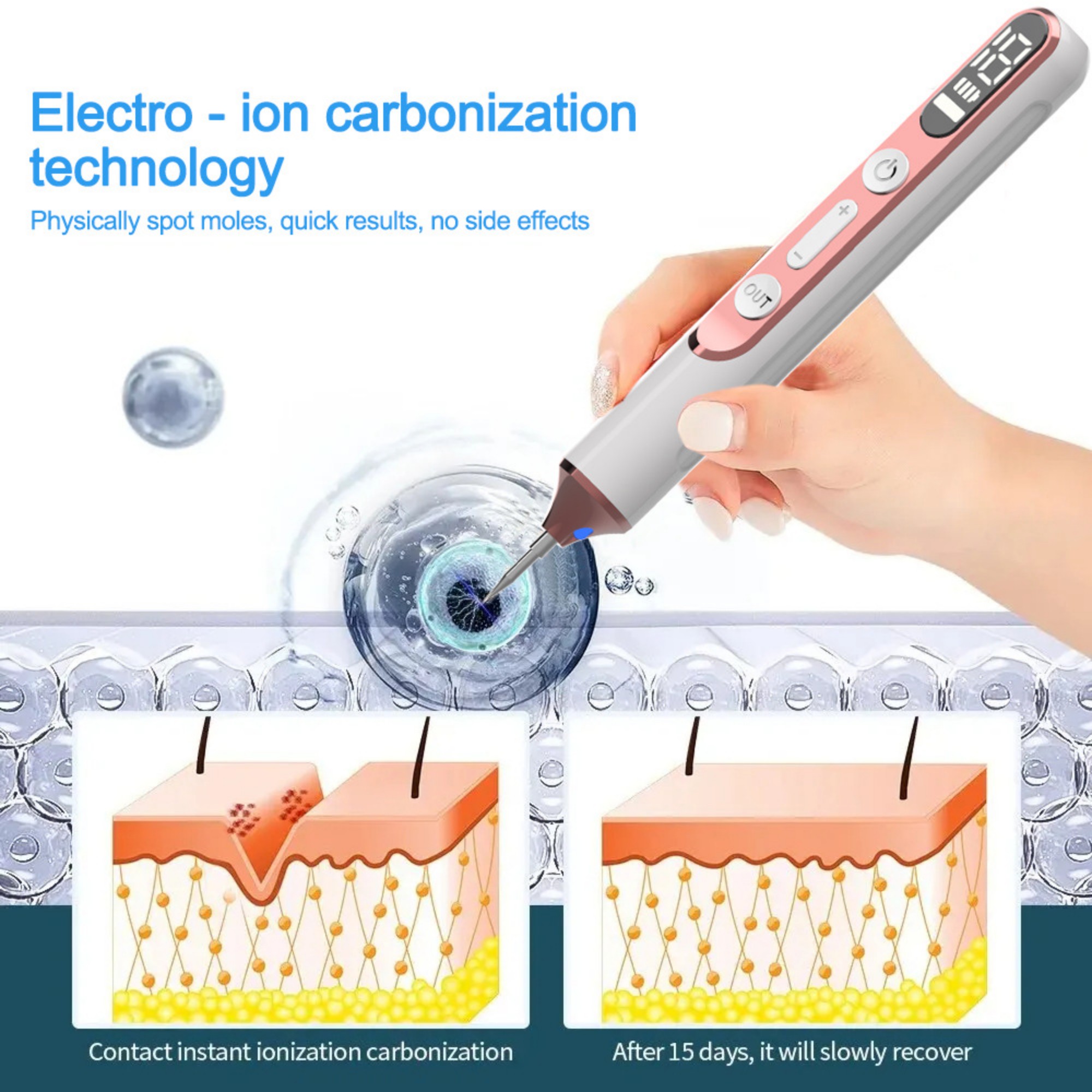 19-Level LED Spot Removal Pen 5