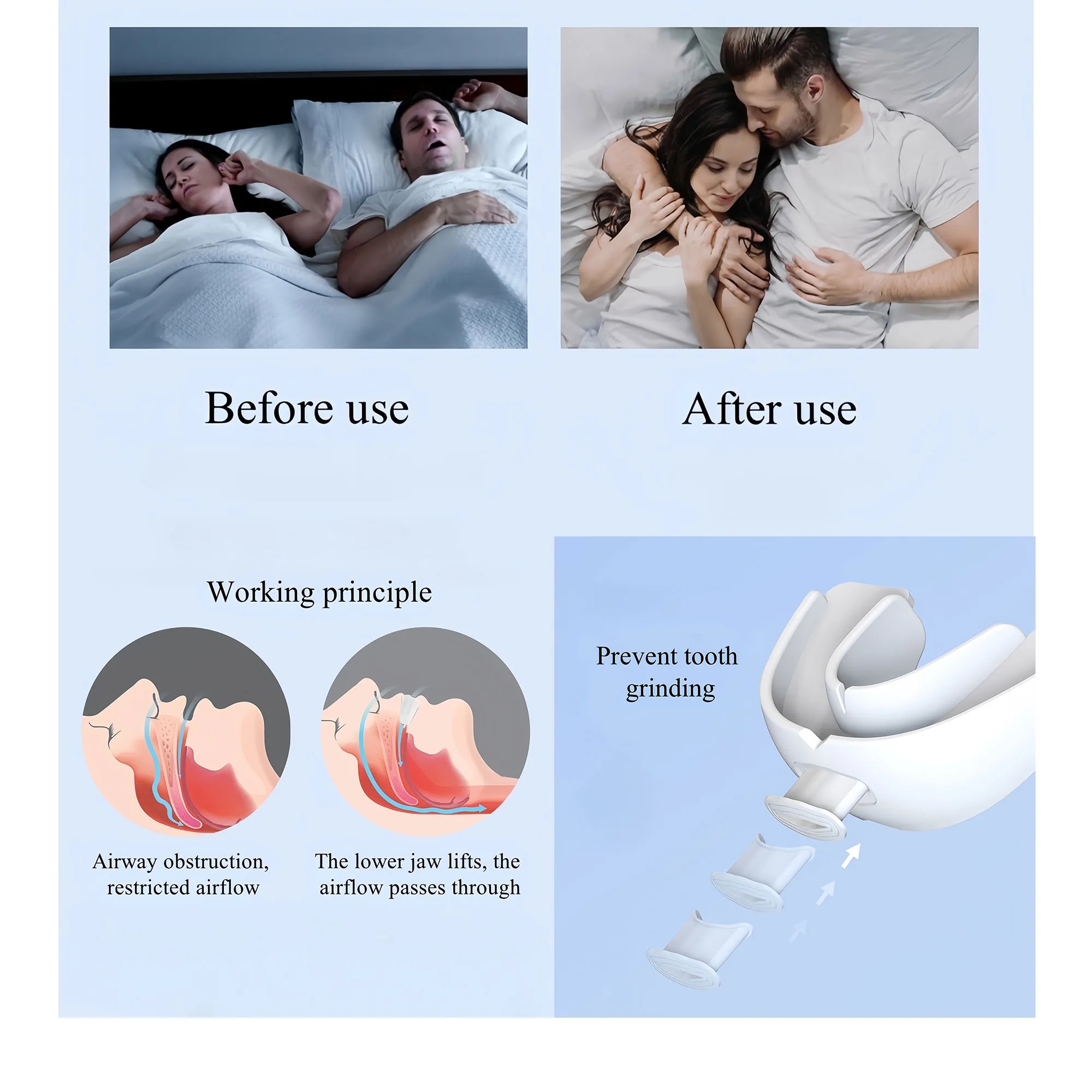Multi-functional Anti-Snoring Dental Guard 2
