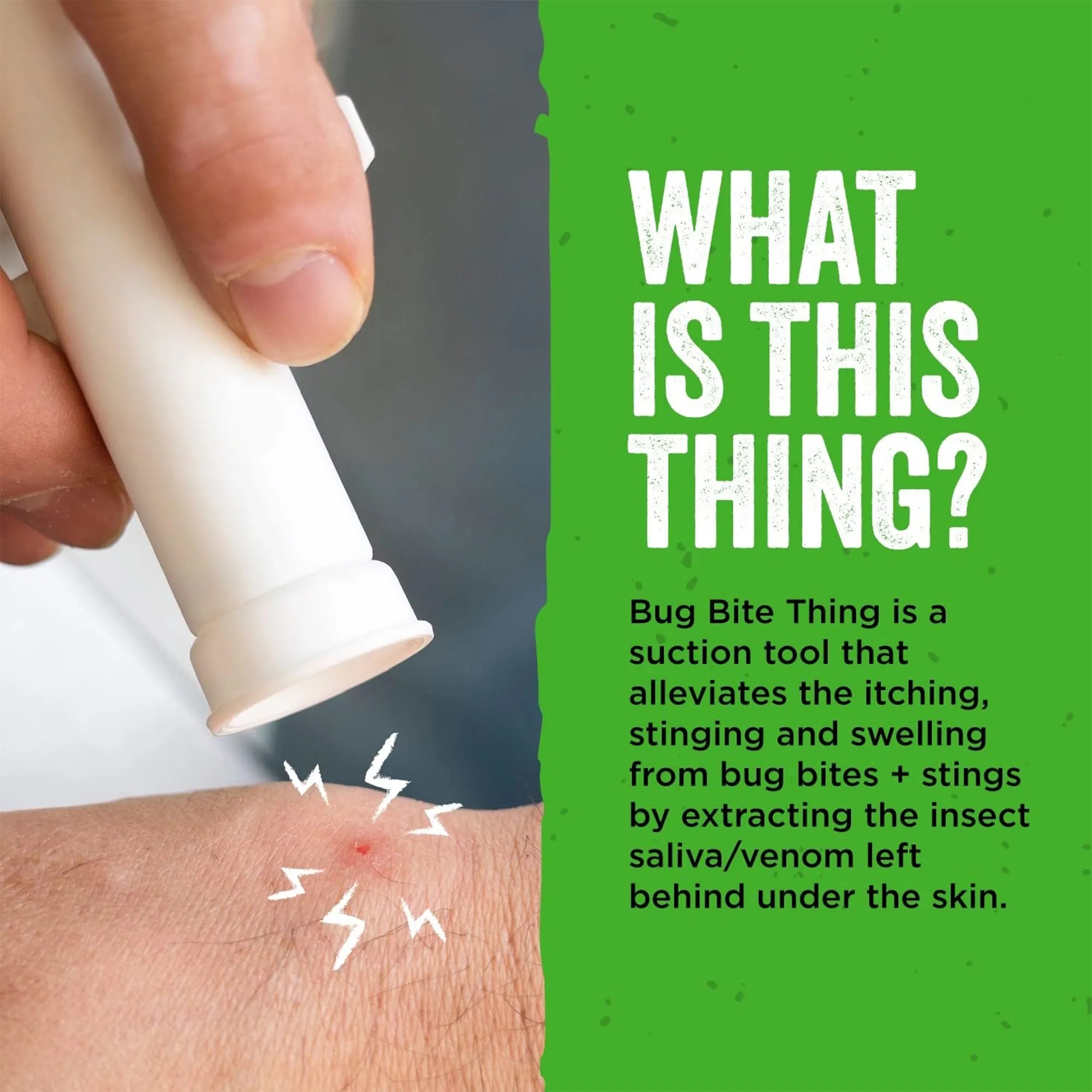 Vacuum Bug Bite Thing Suction Tool 2