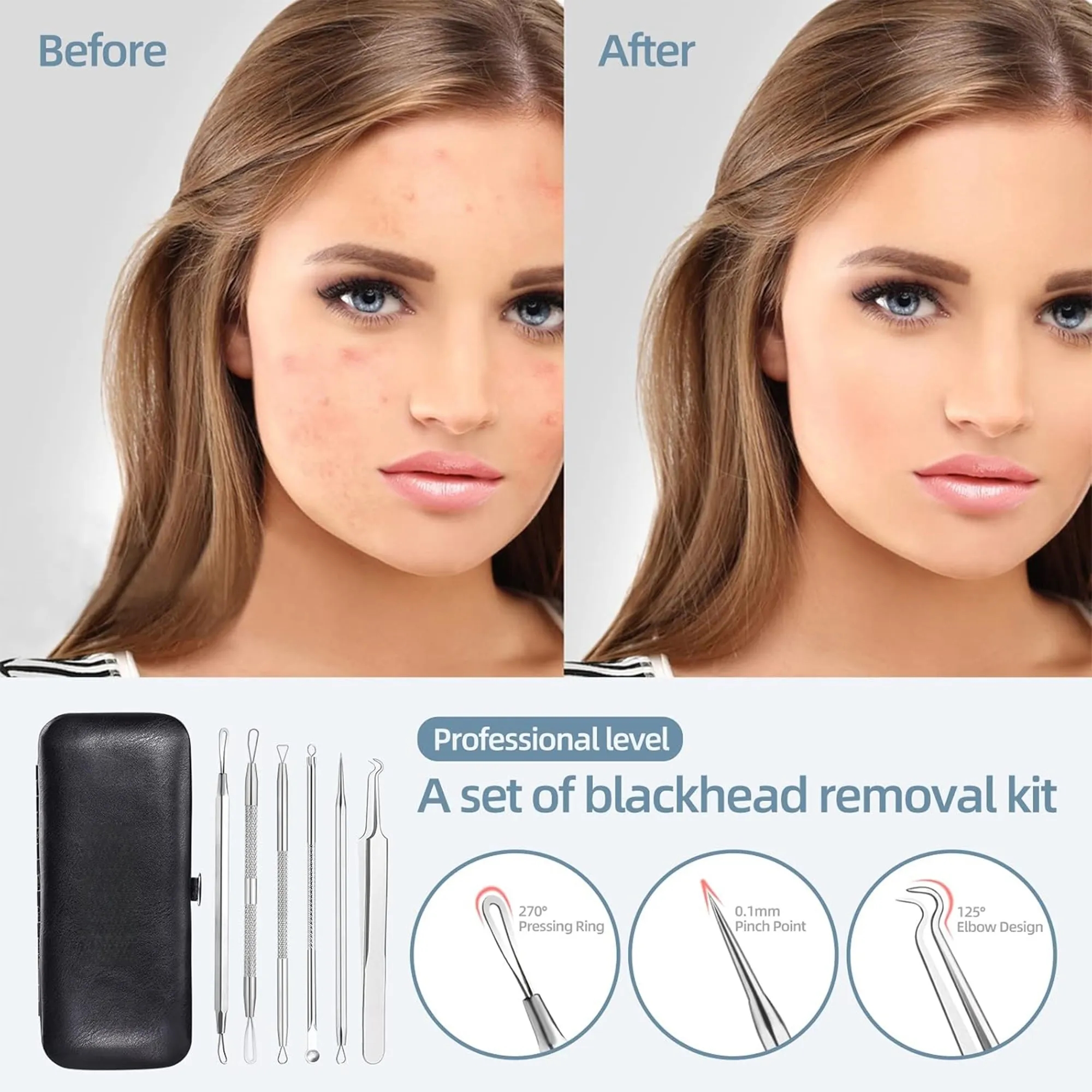 Stainless Steel Blackhead Remover Kit 4