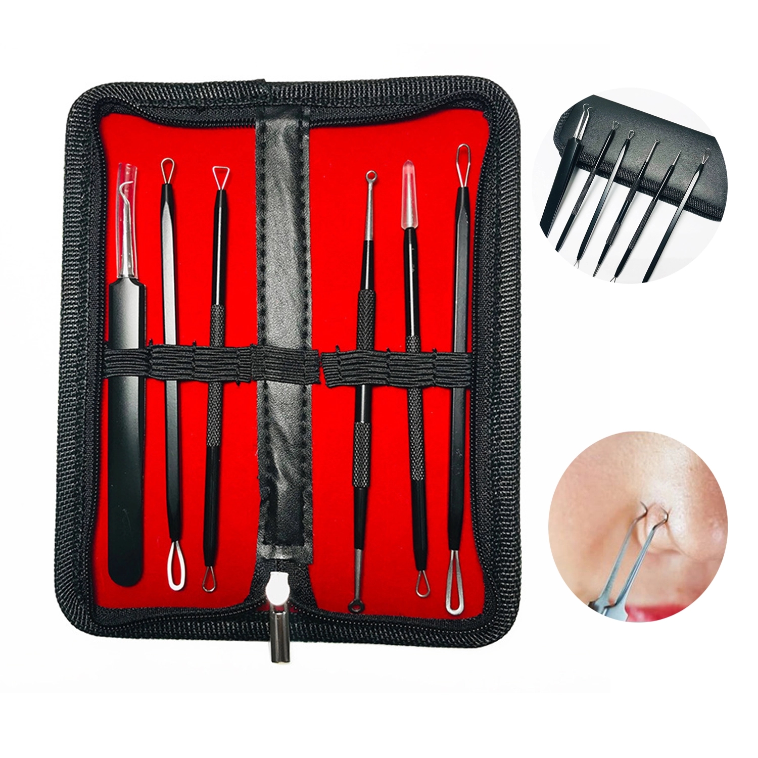 6 Pcs Acne Remover Needles Set 1