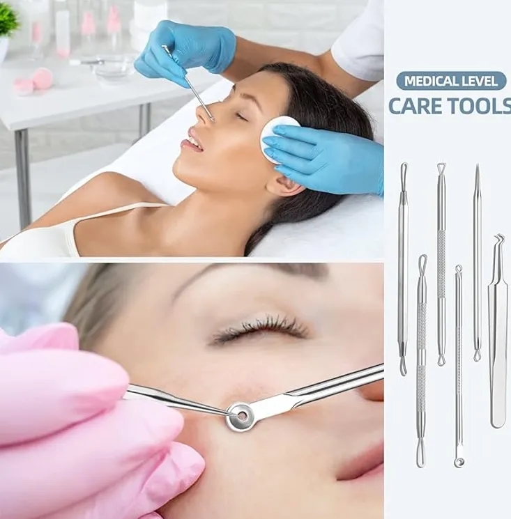 9pc Pimple Popping Tools Comedone Extractor Set for Facial Blemish Removal 1