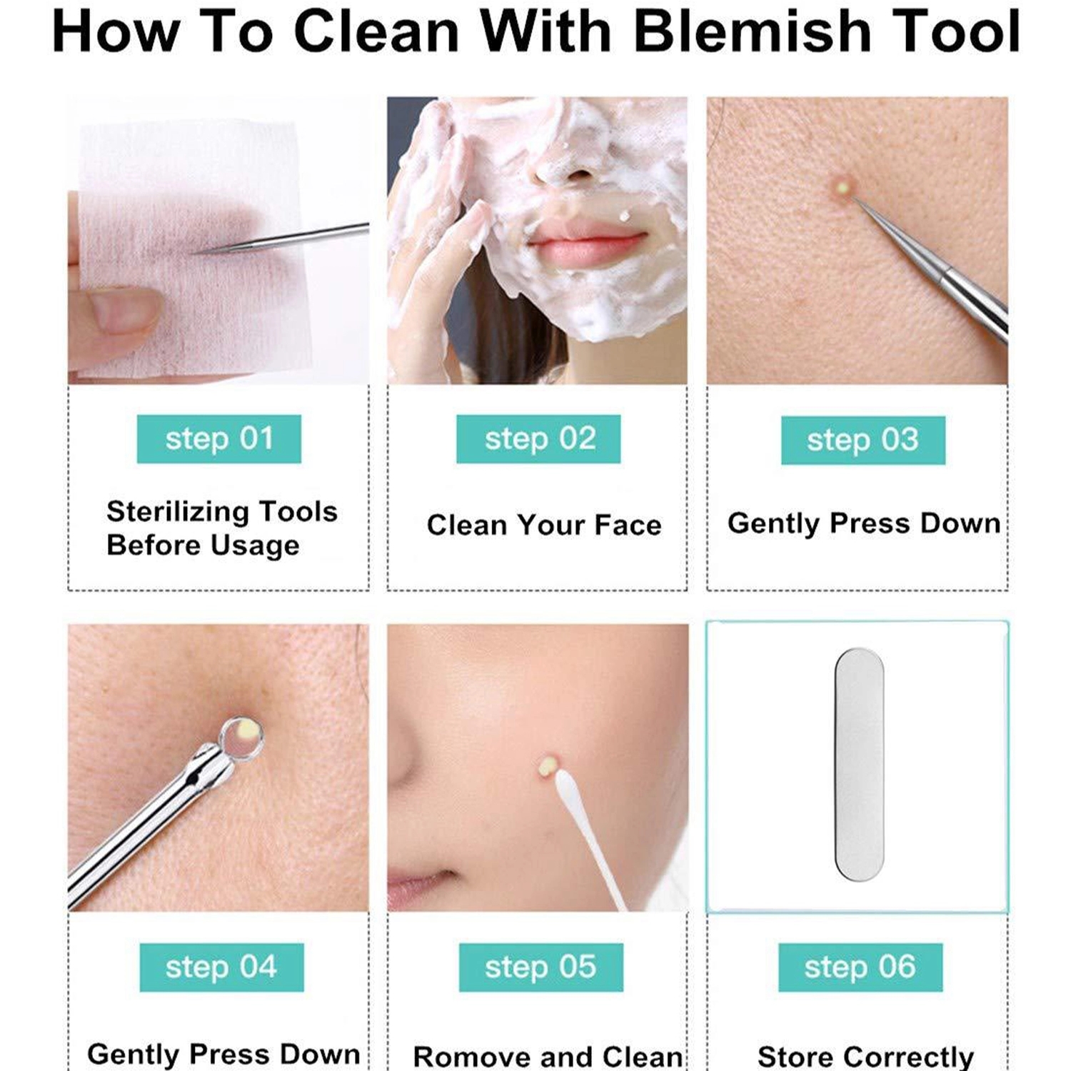 8 Pcs Acne Remover Needles Set 4