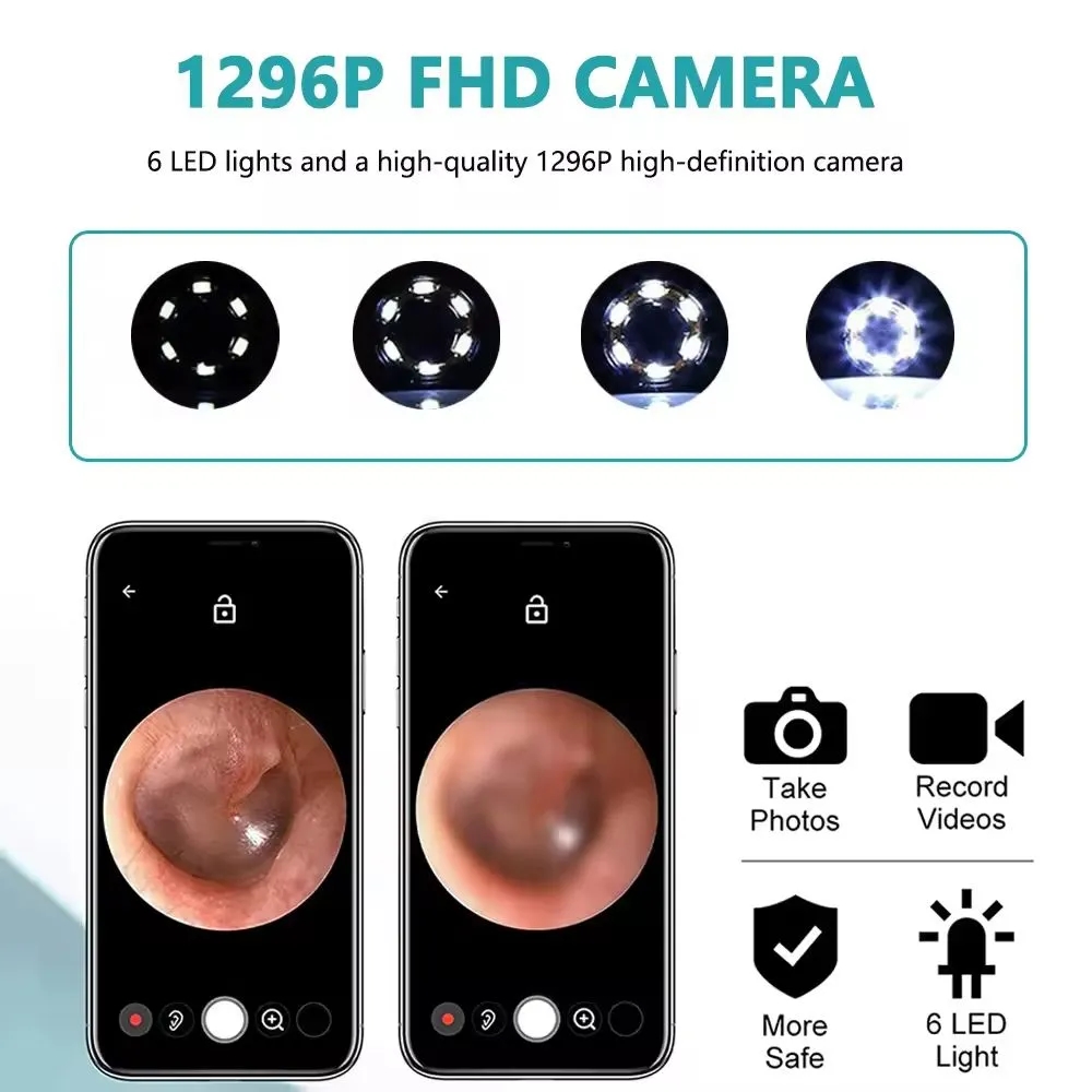 Wireless Ear Cleaner with Camera 1