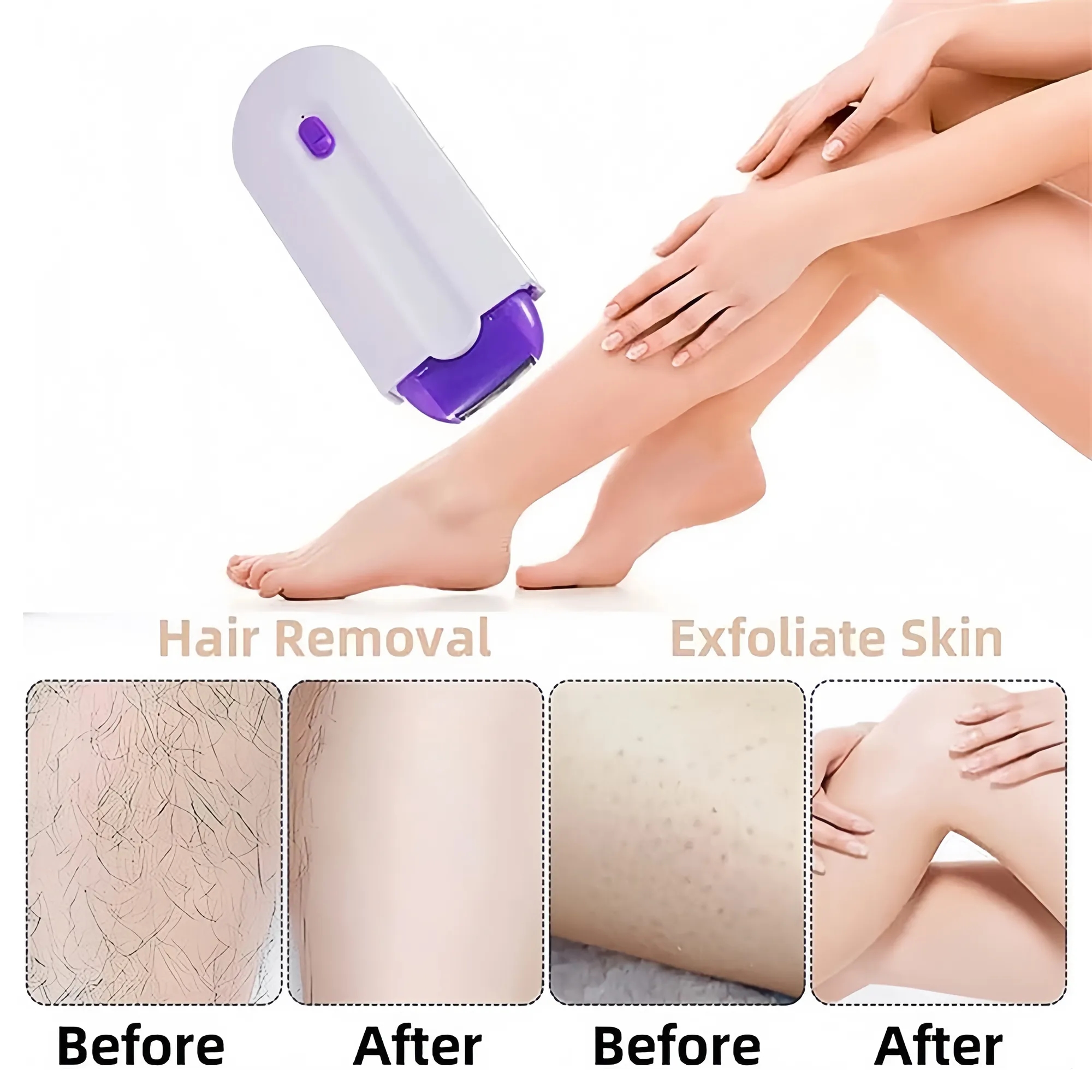 Electric Body Hair Removal Device 9
