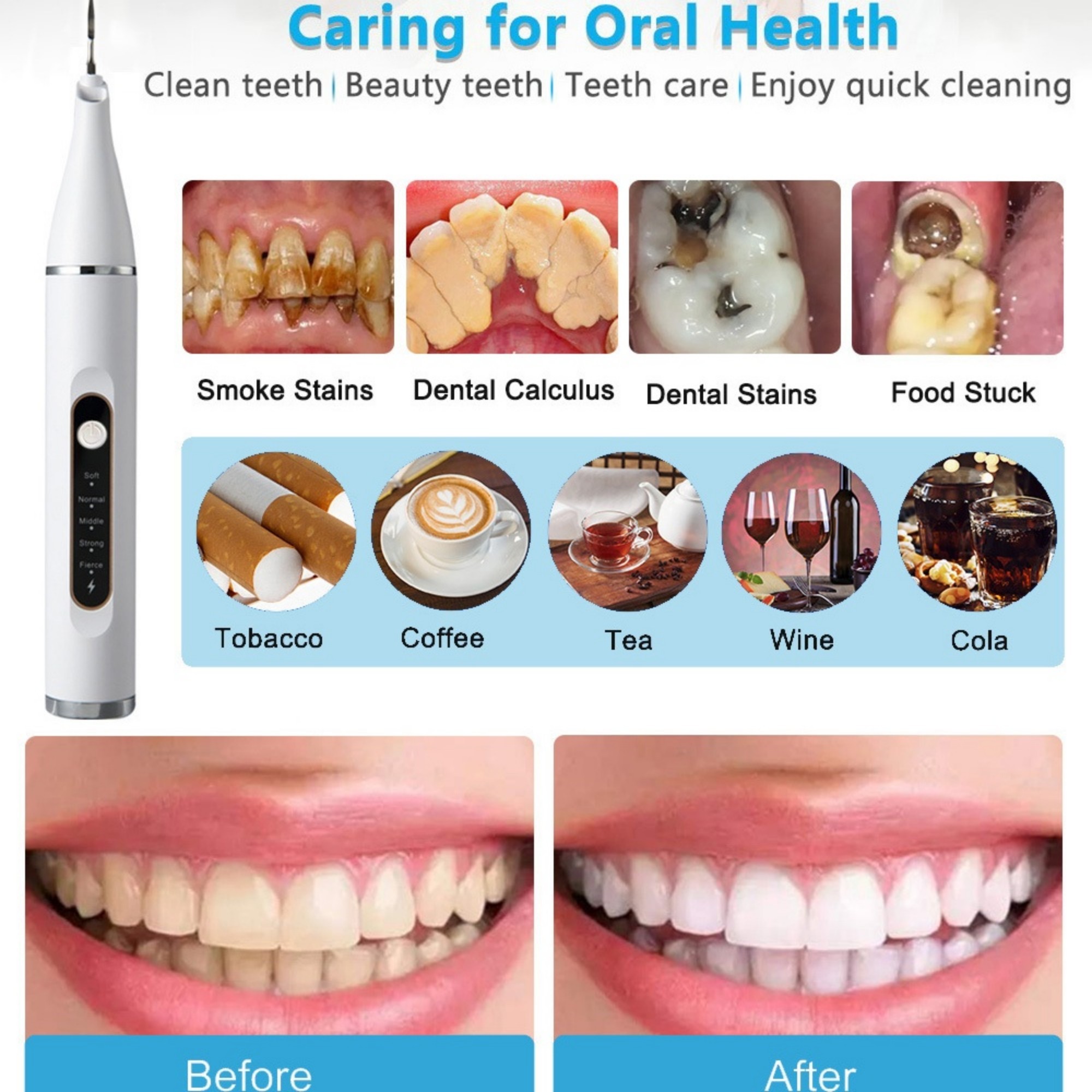 5-Speed Professional Ultrasonic Tooth Cleaner 8