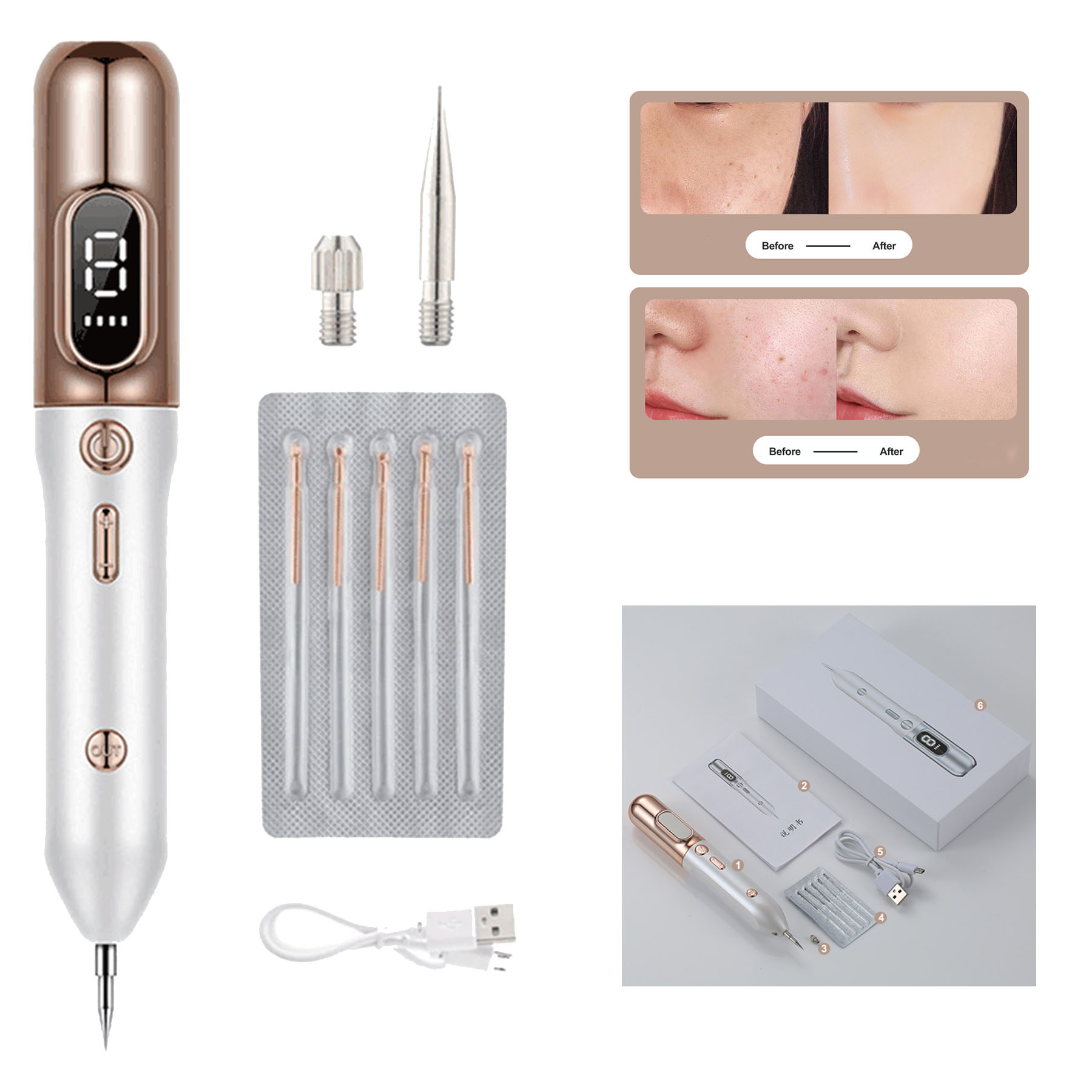 Skin Epidermis Mark Removal 2