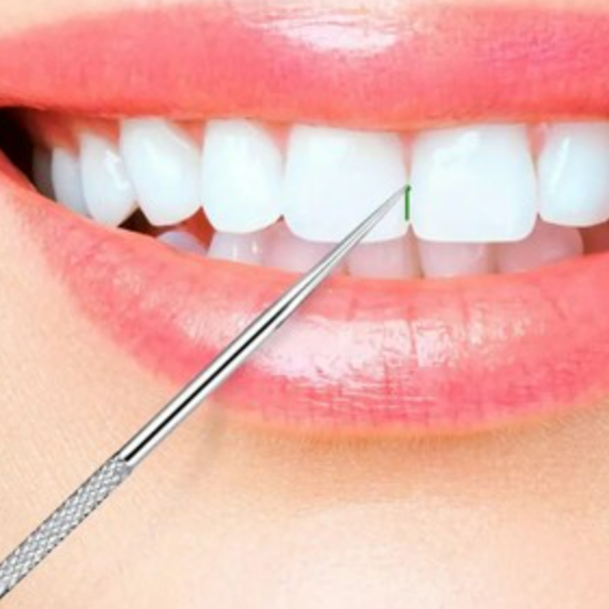 Portable Stainless Steel Oral Care Pick Kit 3